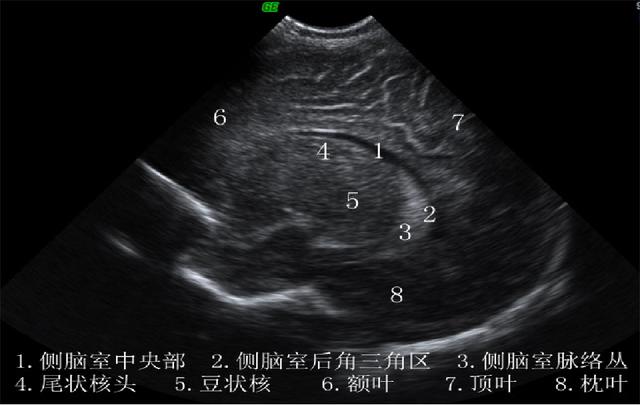 超声学检查是什么意思