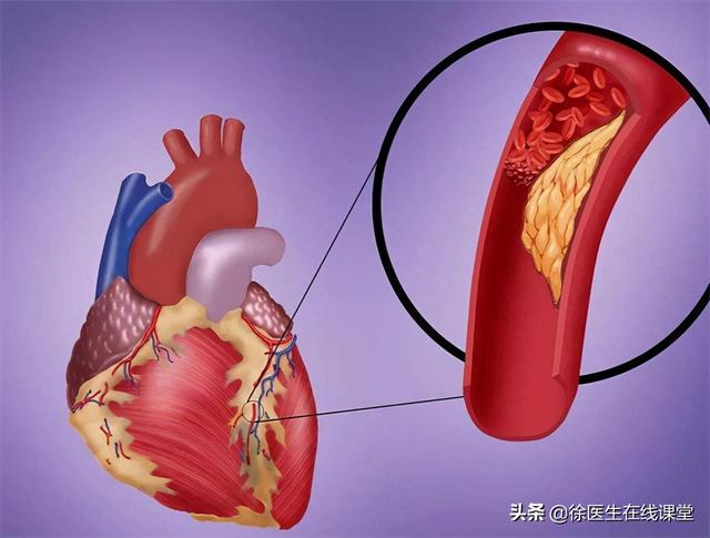 胆固醇高，甘油三酯高，不吃降脂药能好吗？这是为什么？