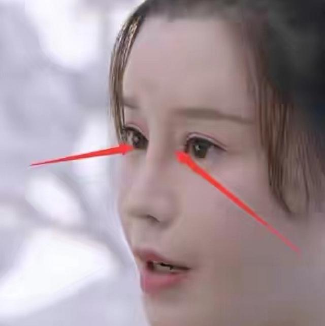 袁心冉:整容明星出演电视剧，一眼看出破绽