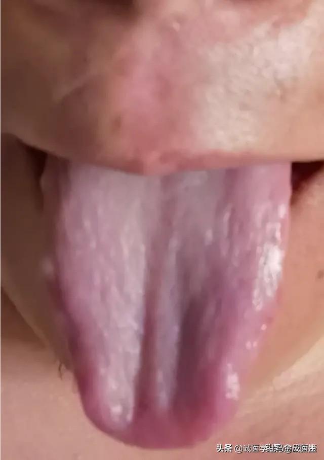 六种不同常见体质，看你属于哪种，看哪种方法适合你