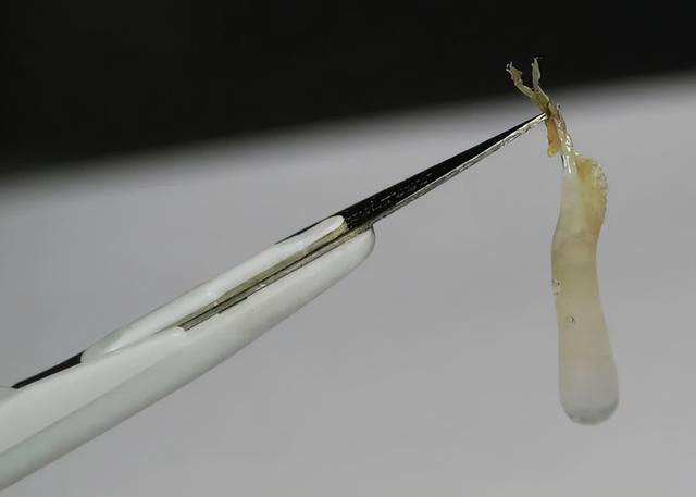 为什么你会有耳屎、眼屎和鼻屎？它们都是怎么来的？本文来揭秘