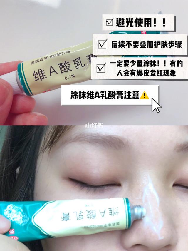 激光能去除毛周角化