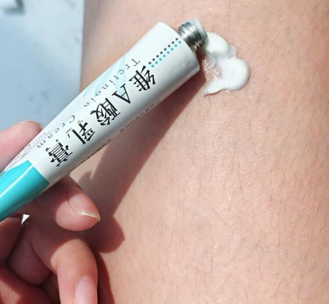 维a酸乳膏可以去除鸡皮肤吗