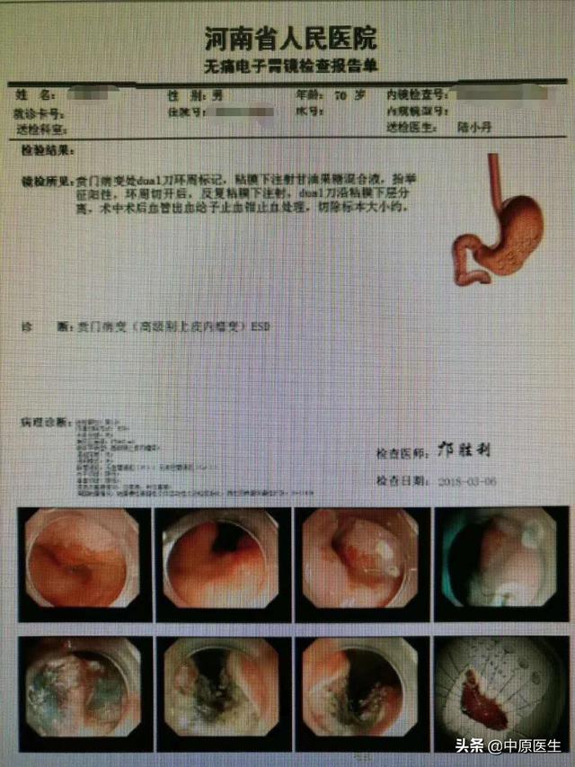 贲门读音图片