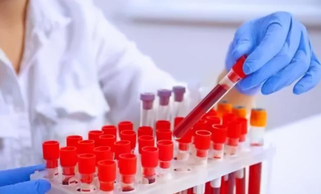 体检时查出这5种病，或无需过度治疗，不要自己吓唬自己