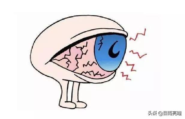 眼角化脓用针挑破