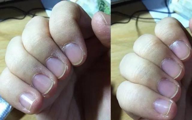 泰国面霜哪个牌子最好用（泰国变态手霜效果堪比）(23)