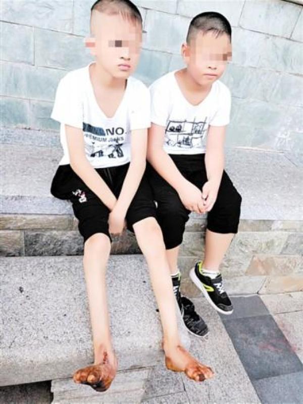 角化病会越来越严重吗