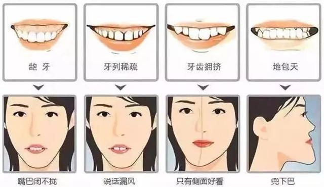 大福利！3D数字化矫正4150元！龅牙走起