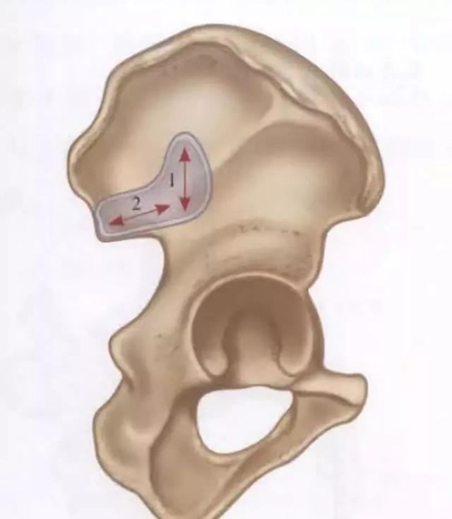 骨盆由髋骨耻骨和骶骨构成（女性耻骨位置示意图）