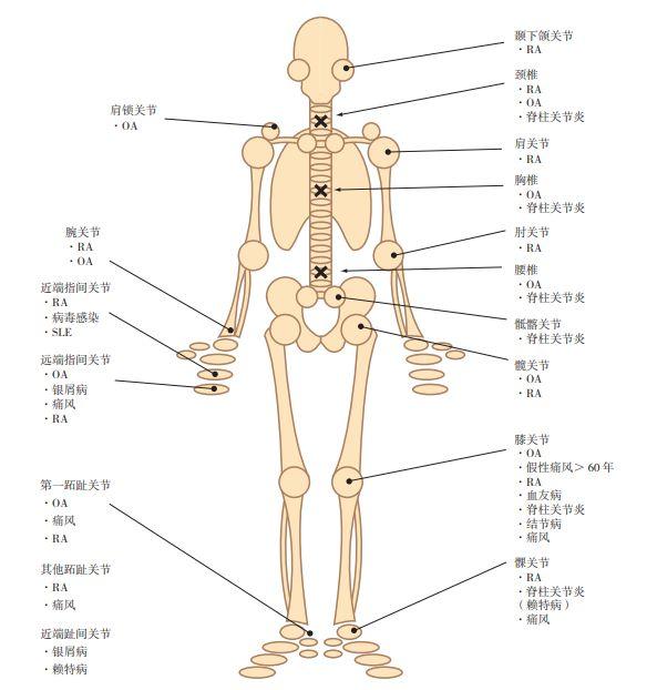 ena检查是什么意思