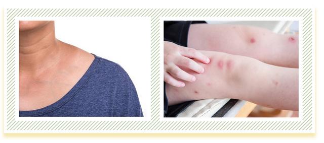 维a酸加入身体乳