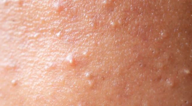 dr.wu杏仁酸精华身体乳