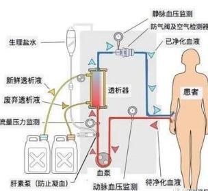 常规过滤机供应