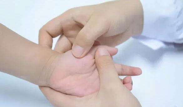 小儿推拿巧化小儿食积