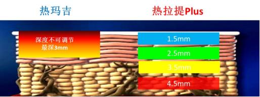 脸部松弛下垂怎么办