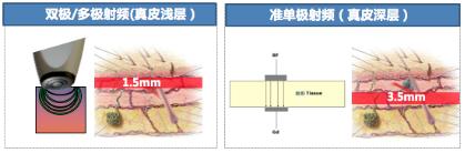 脸部松弛下垂怎么办