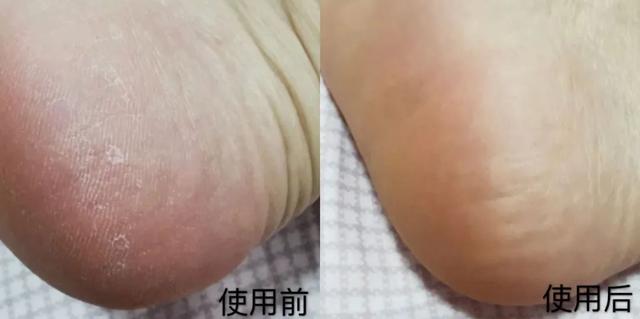秋冬防干裂滋润身体乳 秋冬防干裂滋润身体乳