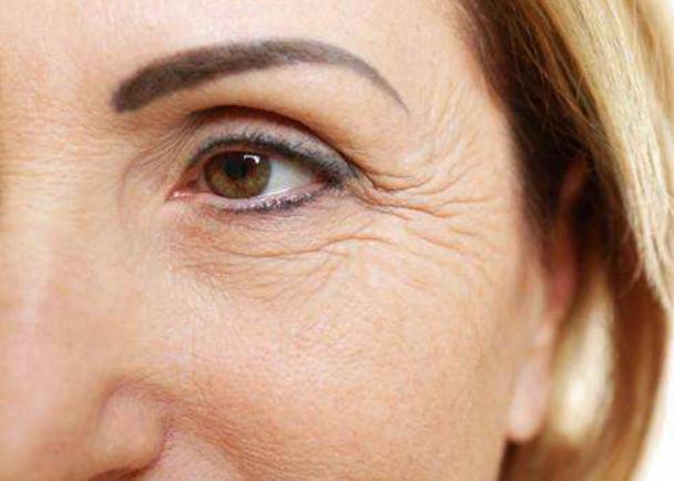 抗衰老脸部皱纹怎样去除