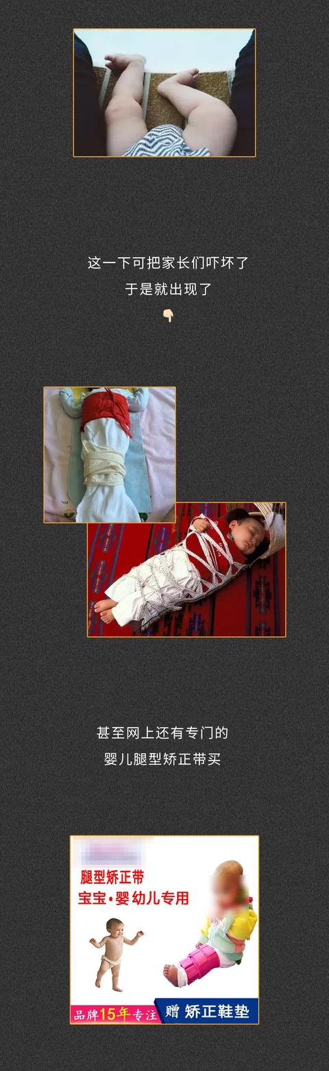 孩子的头都畸形了，他的父母却还在炫耀