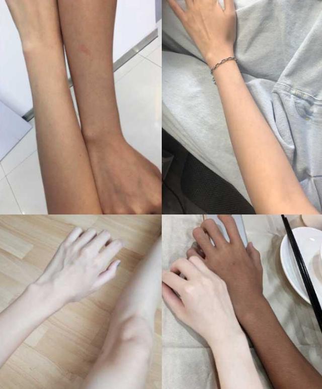 vc粉和身体乳发黄