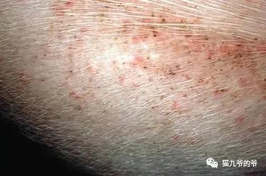 外阴表皮角化不全什么意思