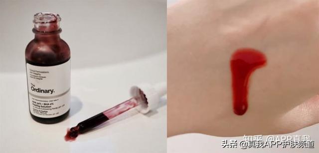 毛周角化和微粉刺
