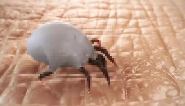 毛囊角化里面挤出来是白色的吗