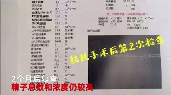男子2次结扎妻子怀孕2次怎么办（男子2次结扎妻子怀孕2次）(1)