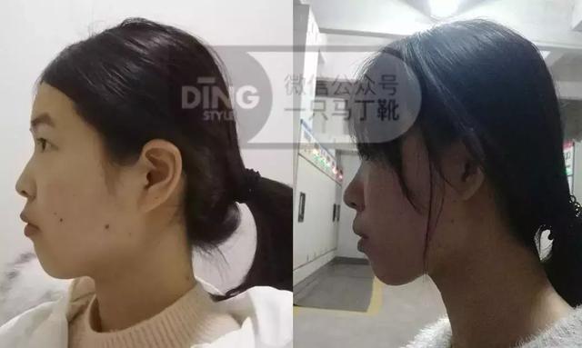 头扁脸宽女人发型图片(头尖额头窄脸宽鼻扁适合发型女)-天晟网