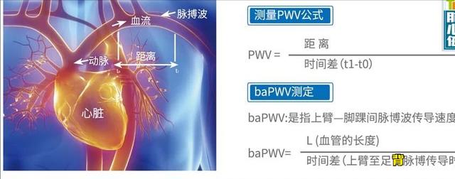 不想得冠心病、心绞痛，不想长期吃药、心脏放支架：做好这三条