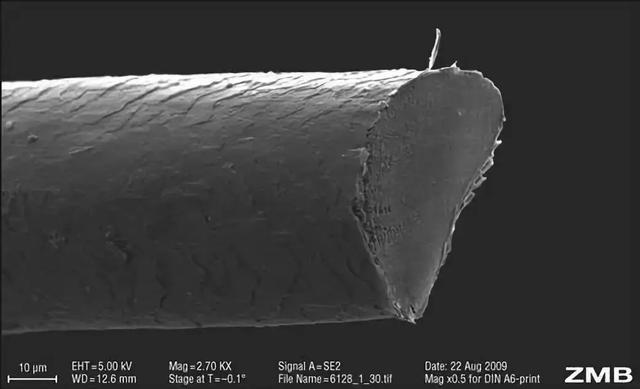 毛发卷曲角化不全