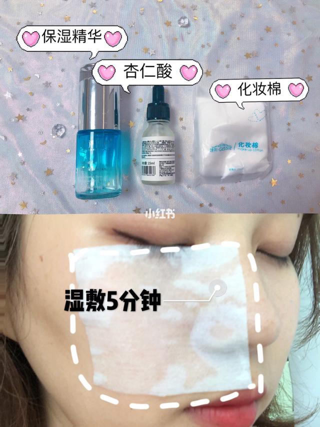 激光能去除毛周角化