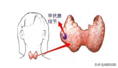 健康科普堂 | 小“硒”作用大，治“甲”作用佳