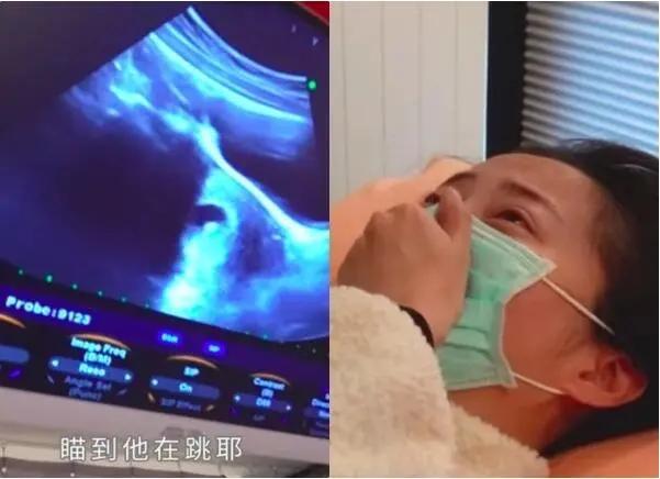 生二胎要趁早，每个高龄产妇都不容易