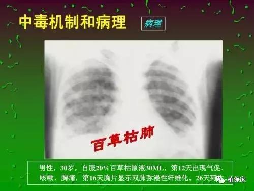 大家是否想念它，曾经叱咤风云多年的————百草枯6