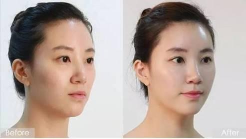 女生清纯什么意思