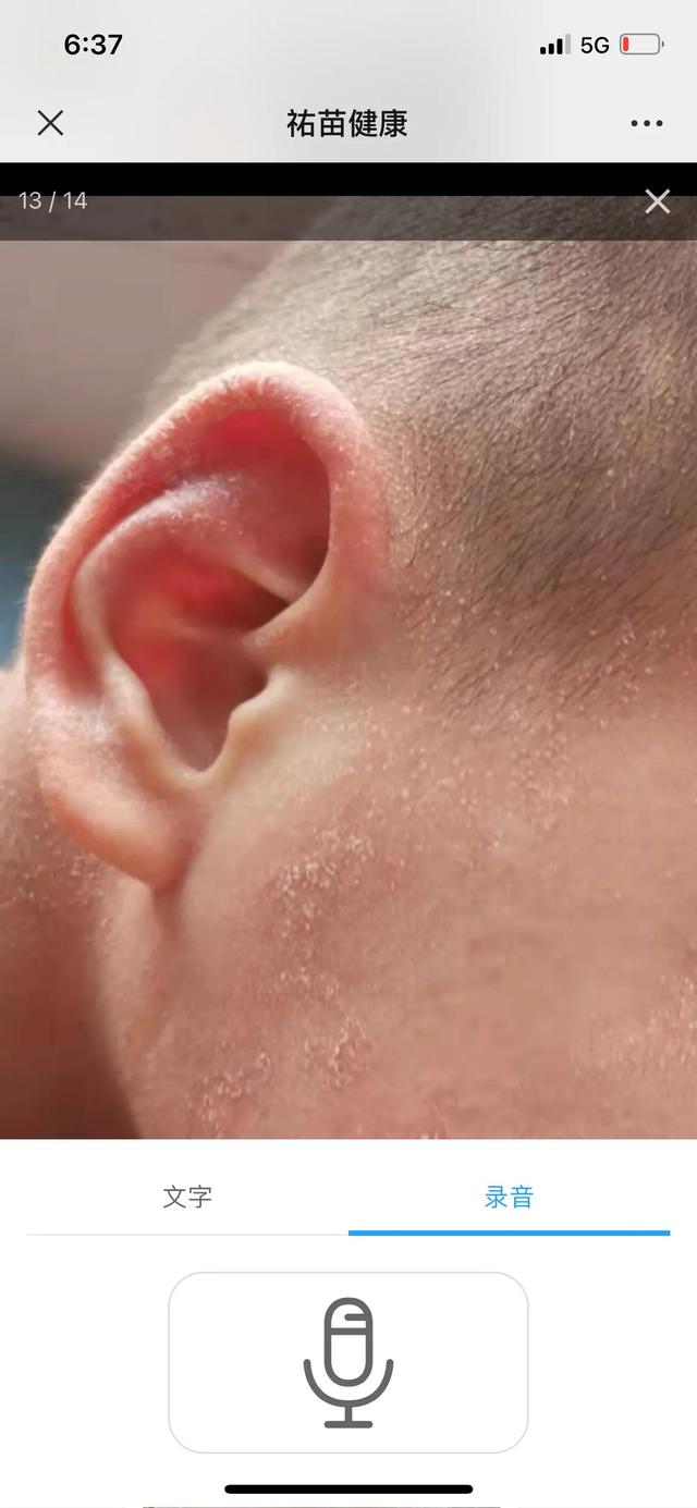 发热皮疹的孩子不少见，但这一例的诊断让人挠头