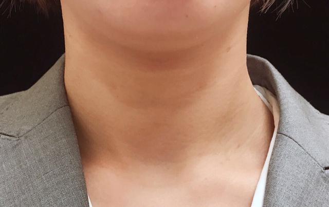 拿身体乳涂在脚上拿塑料包着