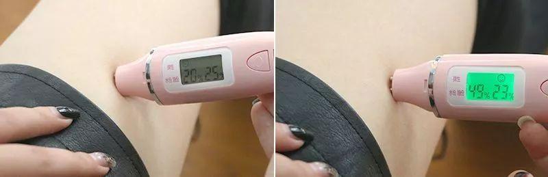 手背皮肤就长鸡皮一样