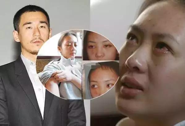 黄定宇控制童瑶近一年:“小章子怡”童瑶：和章子怡同脸不同命，被强奸被家暴她有何苦衷