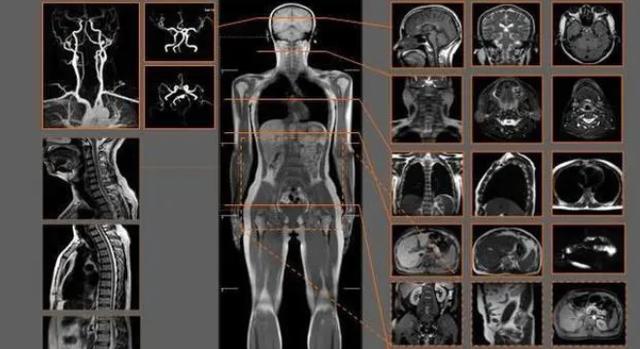 核磁共振为什么尽量不要做？或许你还不知道有这三点有密切的关系