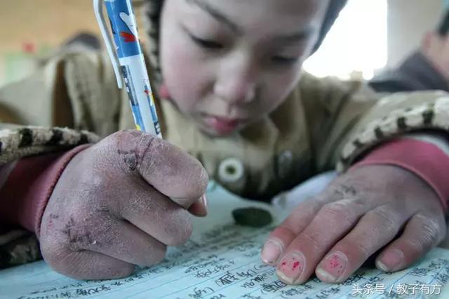 冻伤怎么做 冻伤怎么做（冻伤怎么处理） 生活