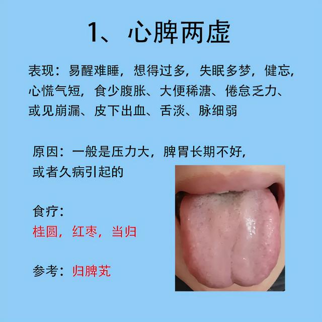 女人常见6种症状，以及对应舌象和解决的方法分享