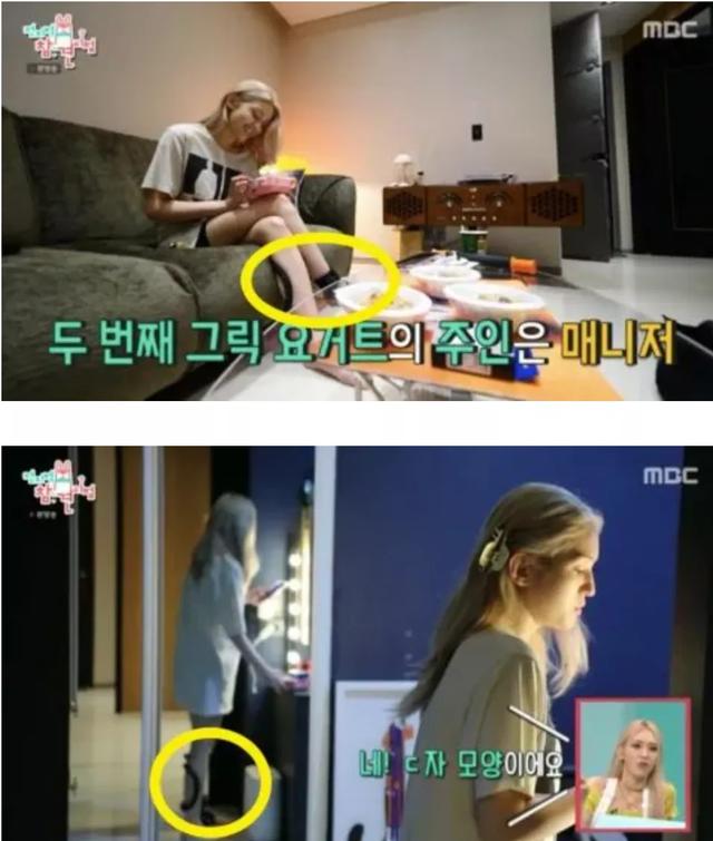 擦身体乳会静脉曲张吗