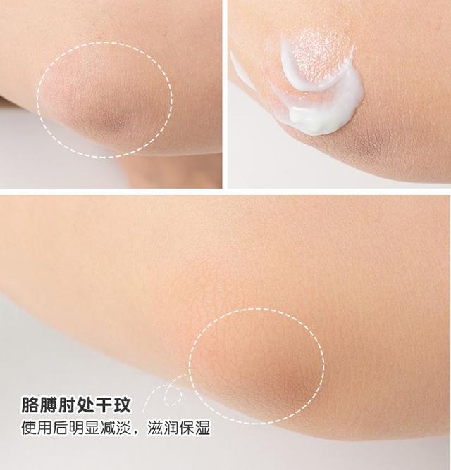 手背皮肤就长鸡皮一样