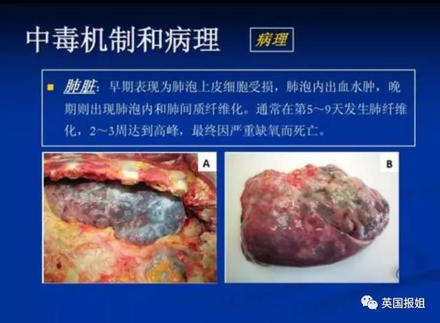 13岁河南女孩喝下百草枯，悲惨折磨触目惊心，“死亡之水”有多恐怖？