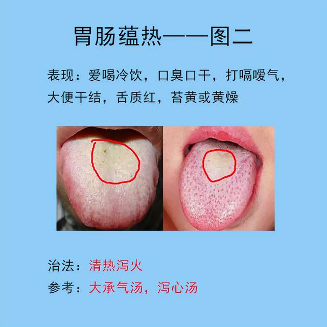 脾胃常见的10种舌象，以及临床表现，后面带解决方法