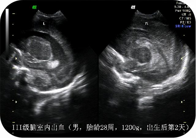 超声学检查是什么意思