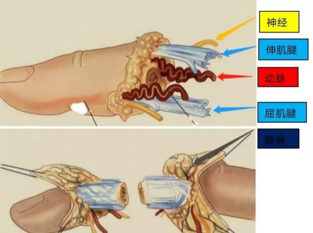 手指断了怎么办